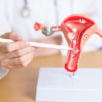 ¿Qué pasa cuando una mujer tiene endometriosis?